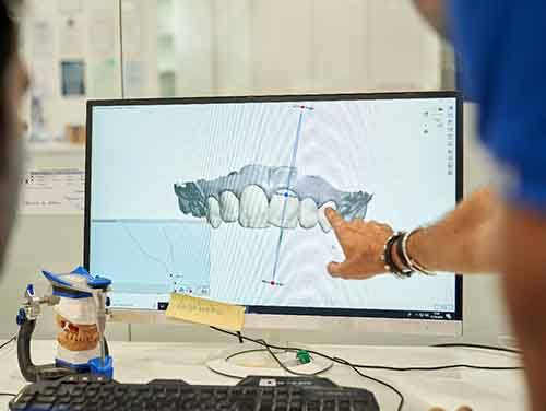 a dentist pointing at a digital impression of a mouth on a screen